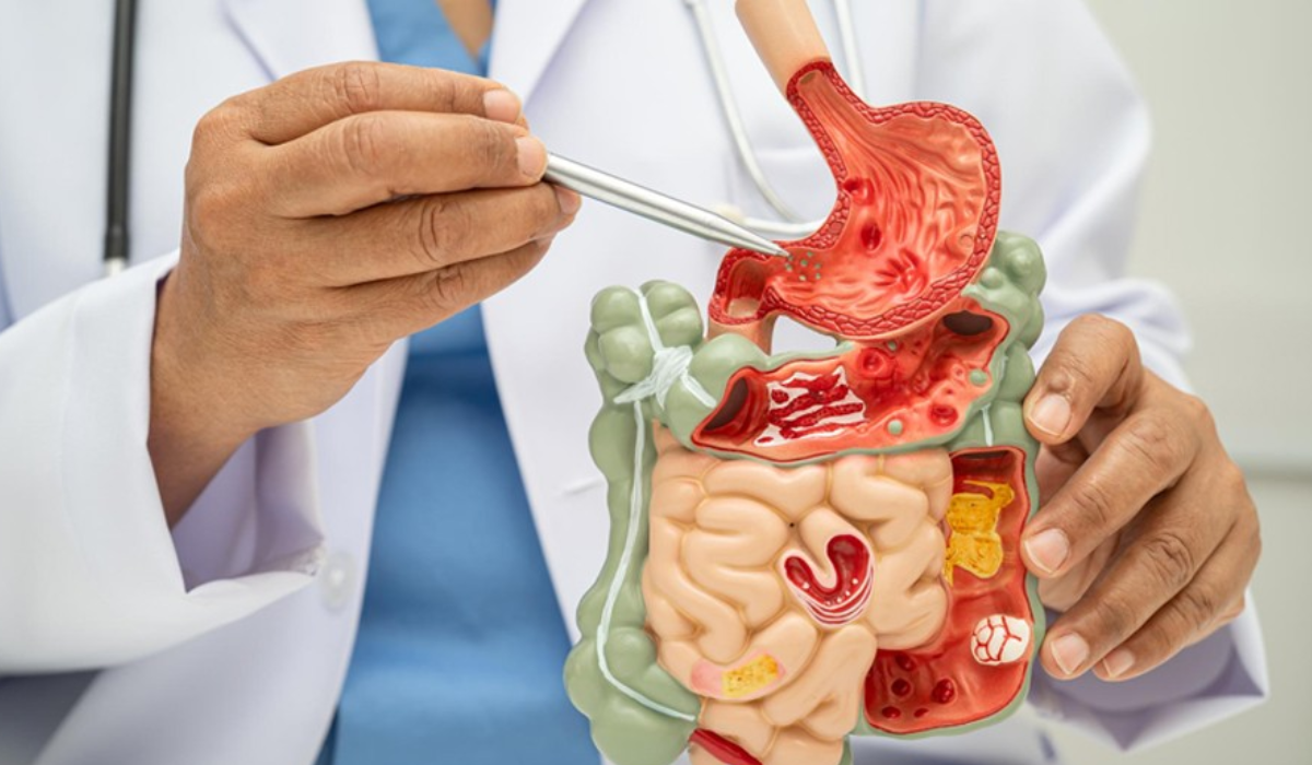 ERCP Cost in Gaur City, Greater Noida: 2026 Complete Procedure Pricing Guide