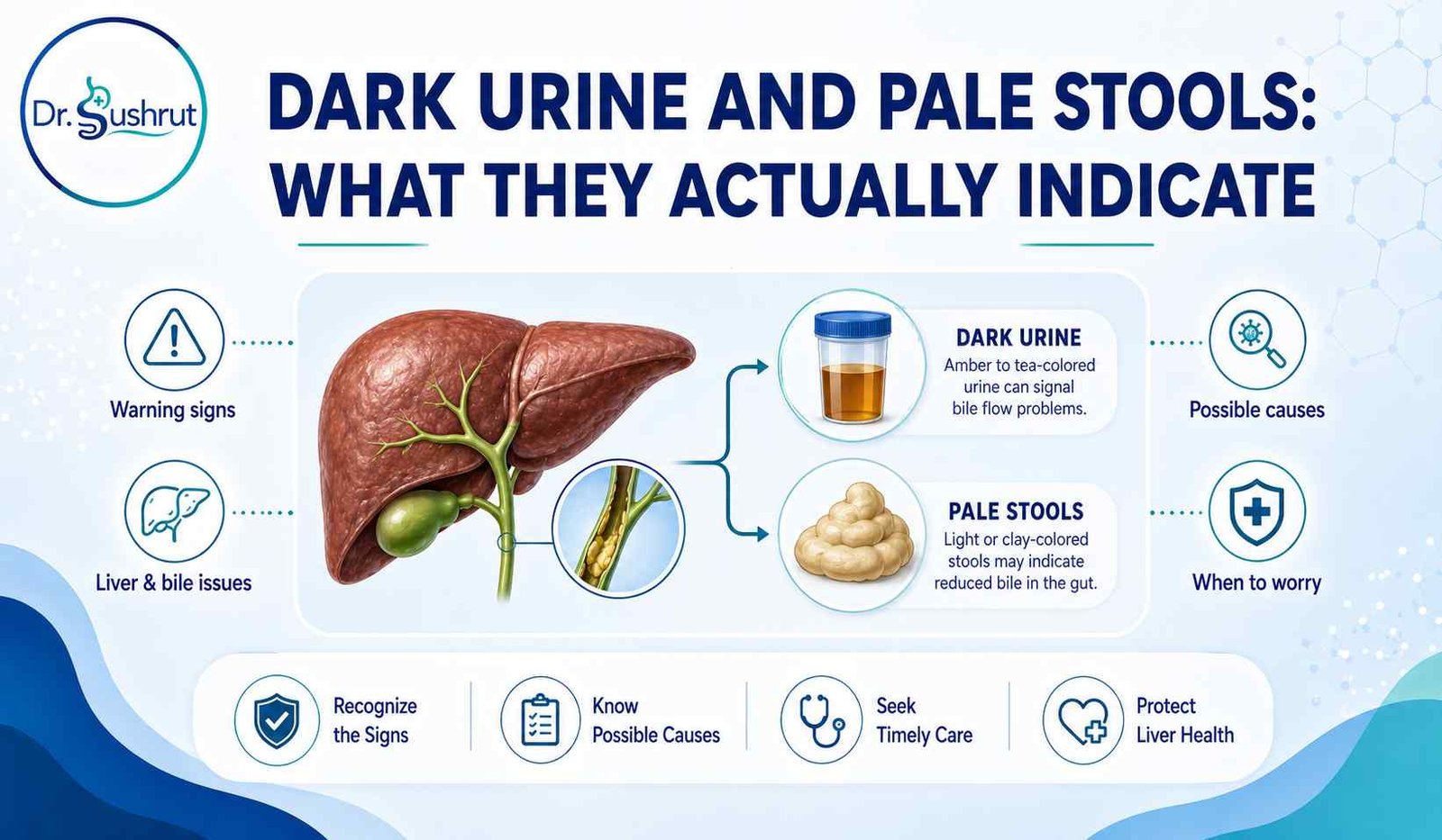 Dark urine and pale stools infographic: bile flow warning signs and when to worry. Dr. Sushrut