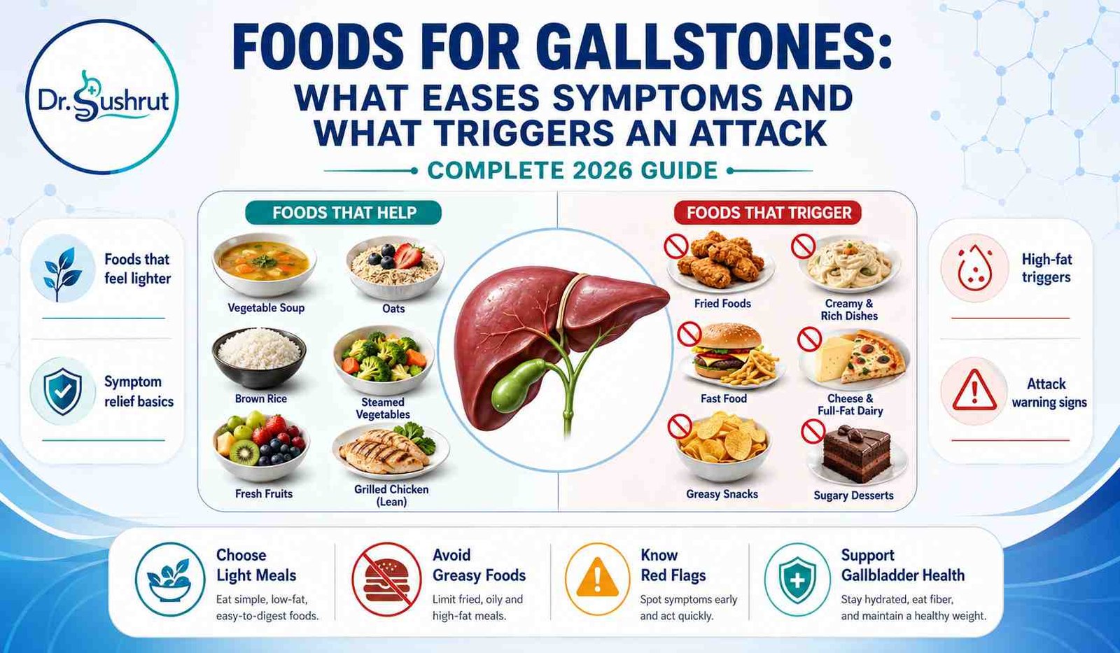 Foods for gallstones infographic: foods that ease symptoms and foods that trigger an attack. Dr. Sushrut