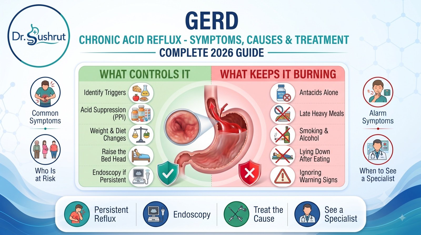 GERD infographic by Dr. Sushrut - what controls acid reflux versus what keeps it burning